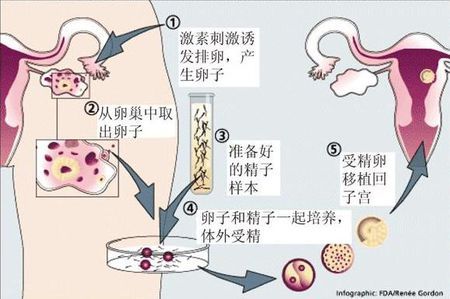 沪上生殖医学中心